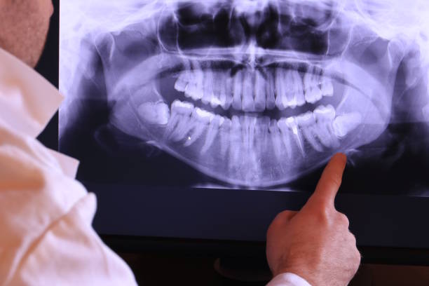 Best Pediatric Emergency Dentist in Sonterra, TX
